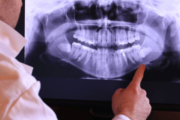 Best Holiday Emergency Dentist in Midlothian, IL