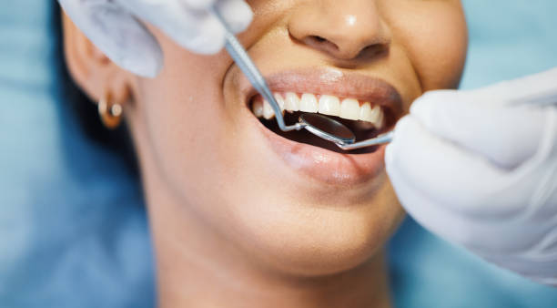 Best Emergency Dentist for Lost Fillings or Crowns in Midlothian, IL